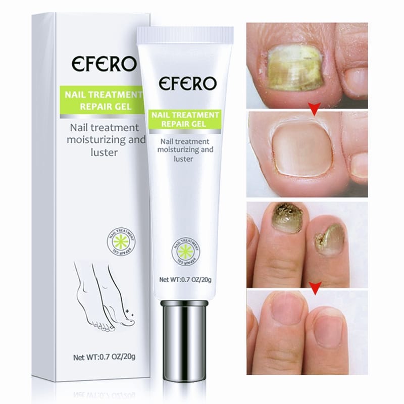 Efero Nail repair gel