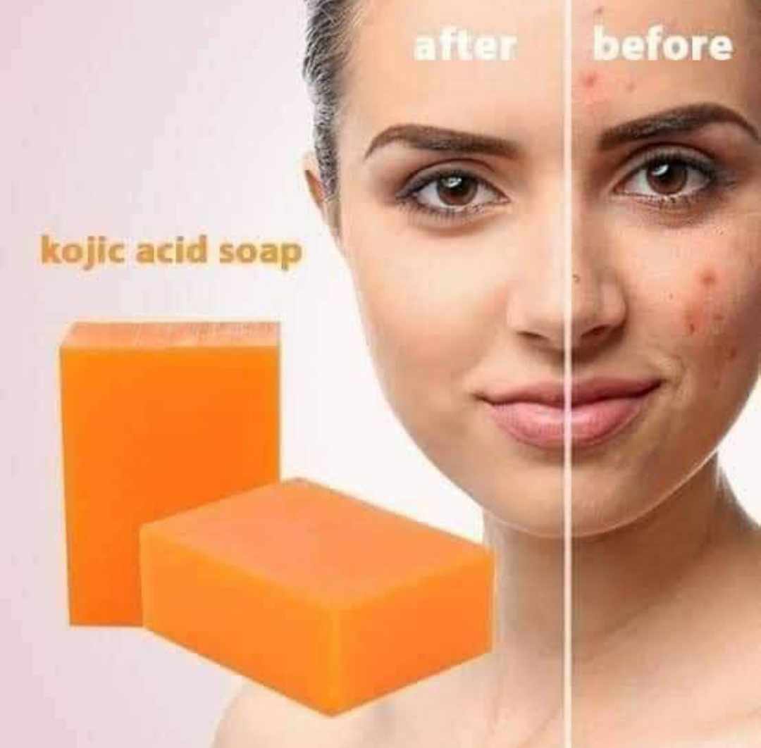 Kojie San soap 135gm